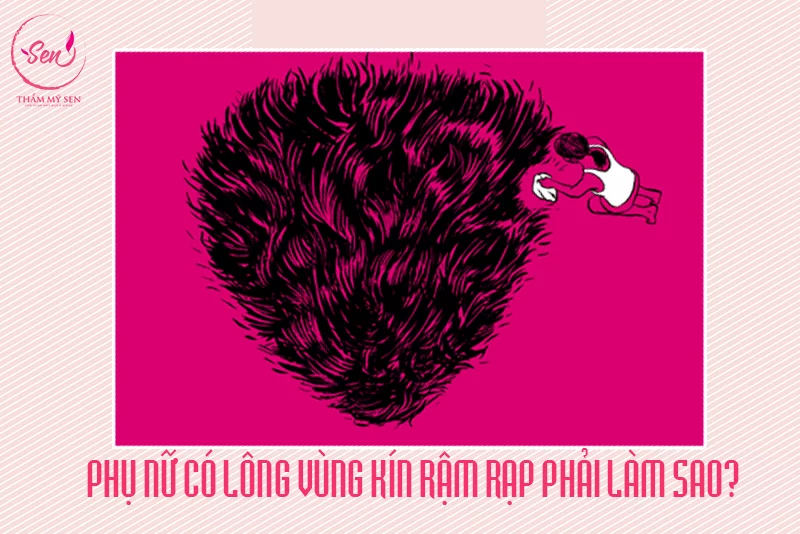 PHỤ NỮ LÔNG NHIỀU TRÊN CƠ THỂ CÓ THỂ LIÊN QUAN ĐẾN NỘI TIẾT TỐ